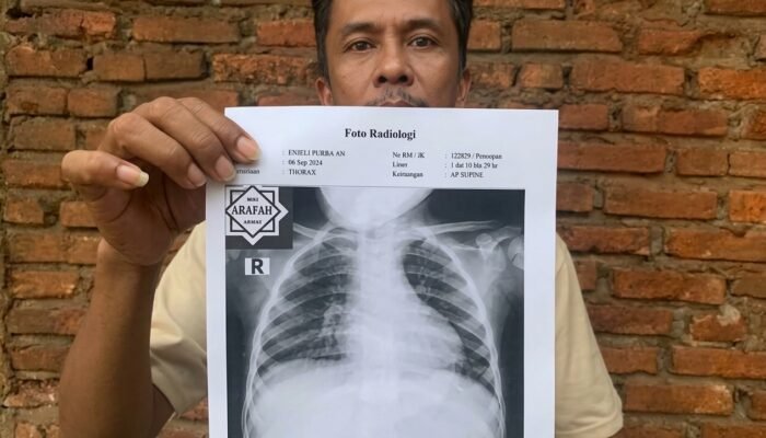Tercekik Asap Karhutla Jambi, Balita Dua Tahun Batuk Berbulan-bulan, Puluhan Ribu Warga Terserang ISPA
