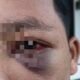 Mata Bengkak hingga Muntah Darah, Siswa Pesantren di Jambi Mengaku Dianiaya Guru